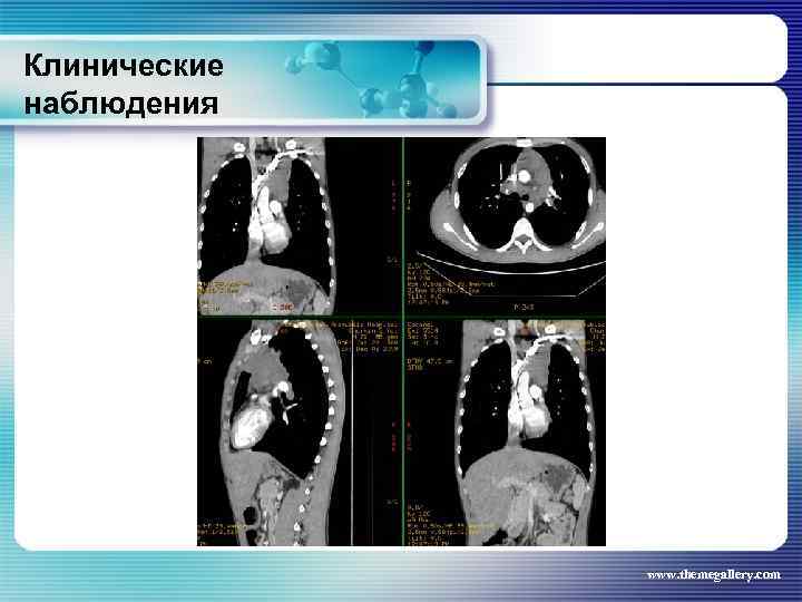 Клинические наблюдения www. themegallery. com 