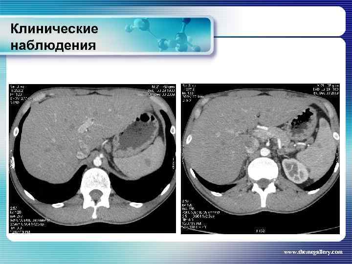 Клинические наблюдения www. themegallery. com 