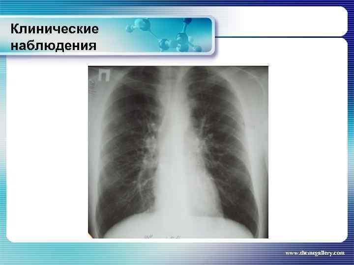 Клинические наблюдения www. themegallery. com 