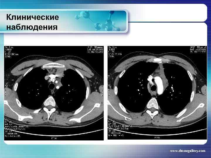 Клинические наблюдения www. themegallery. com 