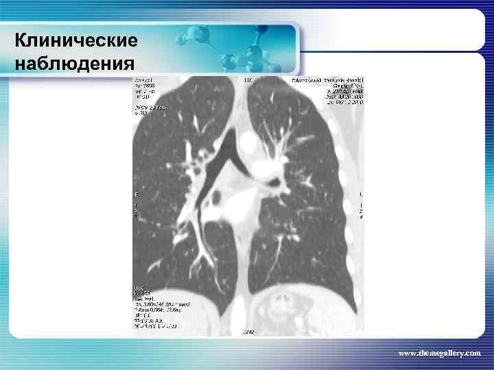 Клинические наблюдения www. themegallery. com 
