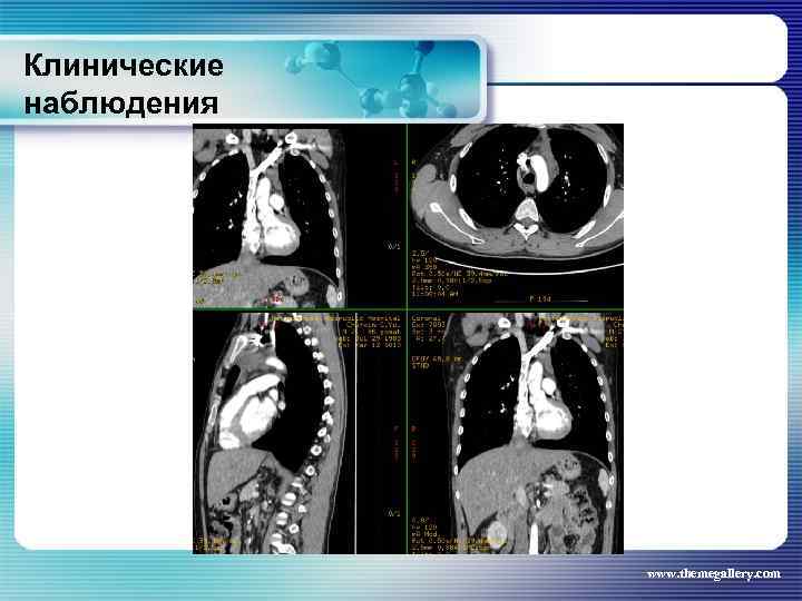 Клинические наблюдения www. themegallery. com 