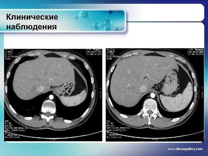 Клинические наблюдения www. themegallery. com 