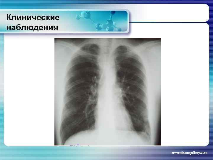 Клинические наблюдения www. themegallery. com 