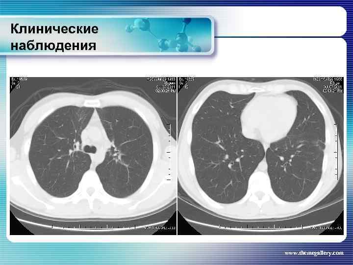 Клинические наблюдения www. themegallery. com 