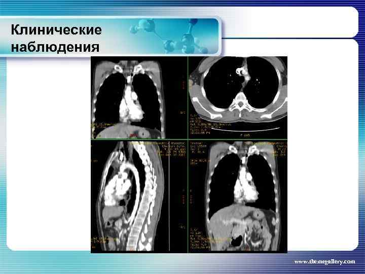 Клинические наблюдения www. themegallery. com 