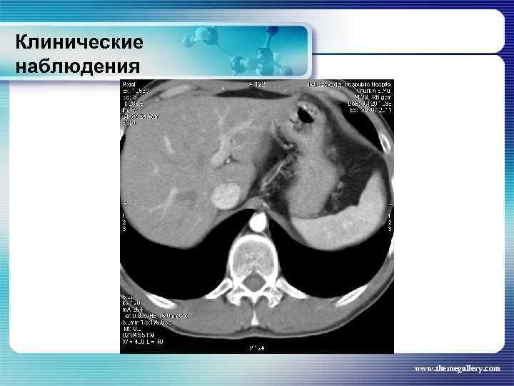 Клинические наблюдения www. themegallery. com 
