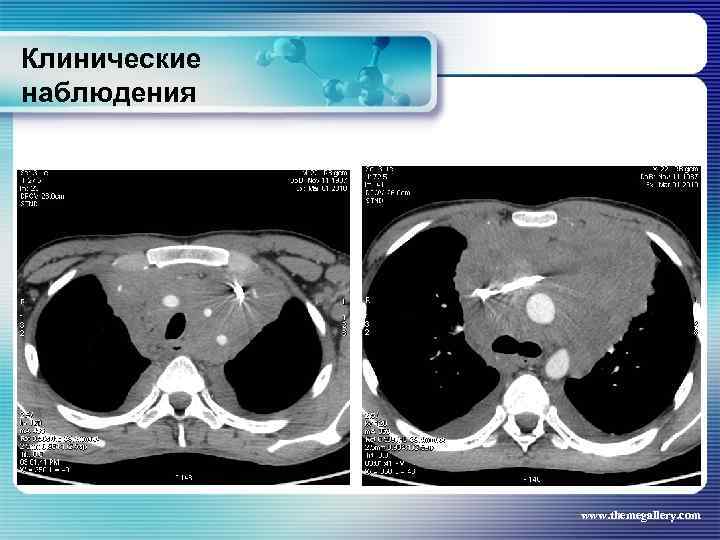 Клинические наблюдения www. themegallery. com 