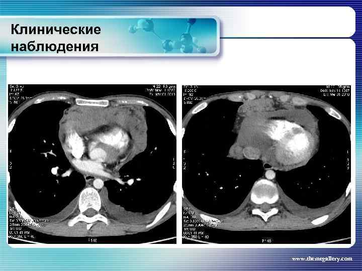 Клинические наблюдения www. themegallery. com 