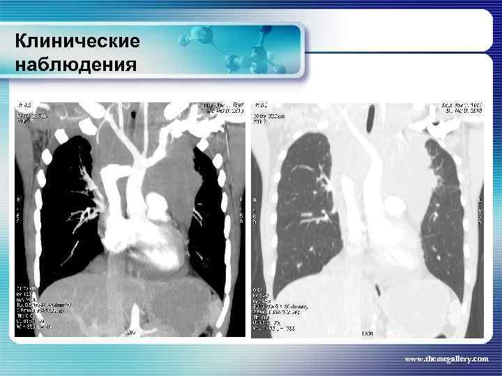Клинические наблюдения www. themegallery. com 