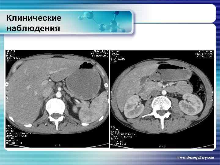 Клинические наблюдения www. themegallery. com 
