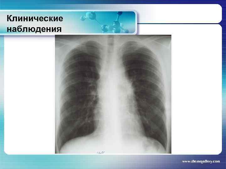 Клинические наблюдения www. themegallery. com 