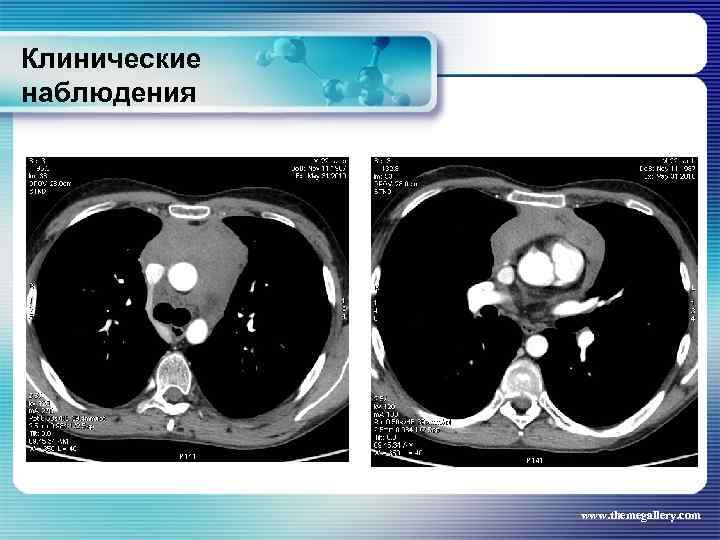 Клинические наблюдения www. themegallery. com 