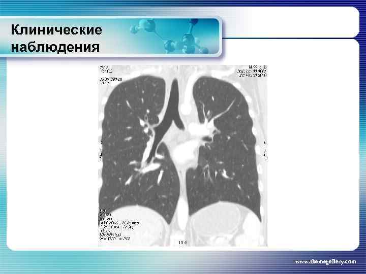 Клинические наблюдения www. themegallery. com 