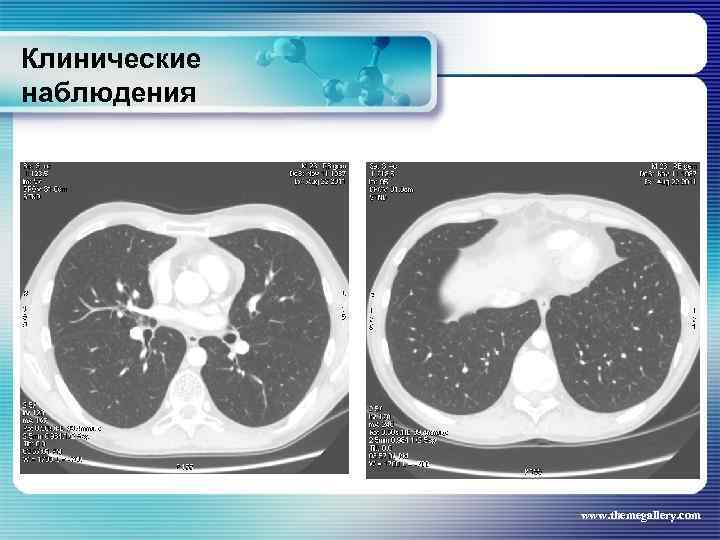 Клинические наблюдения www. themegallery. com 