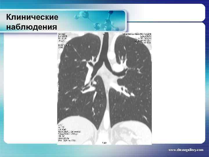 Клинические наблюдения www. themegallery. com 