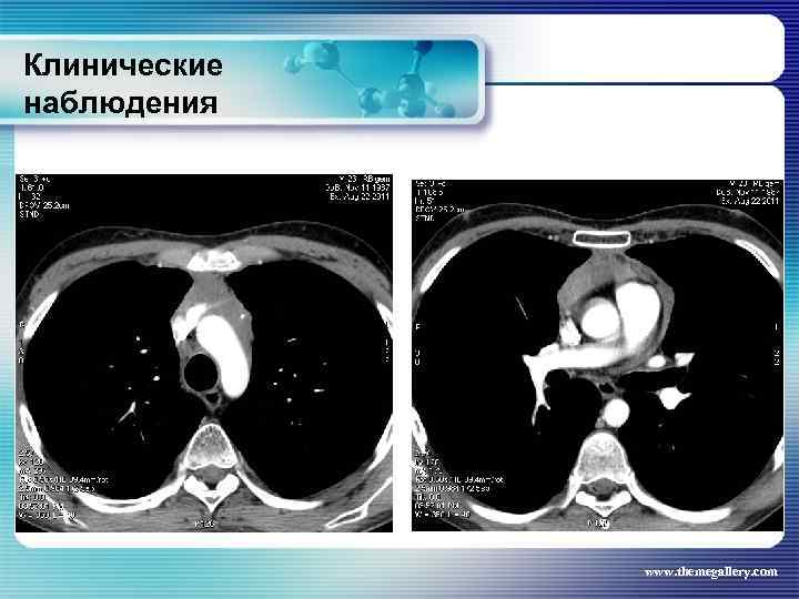 Клинические наблюдения www. themegallery. com 
