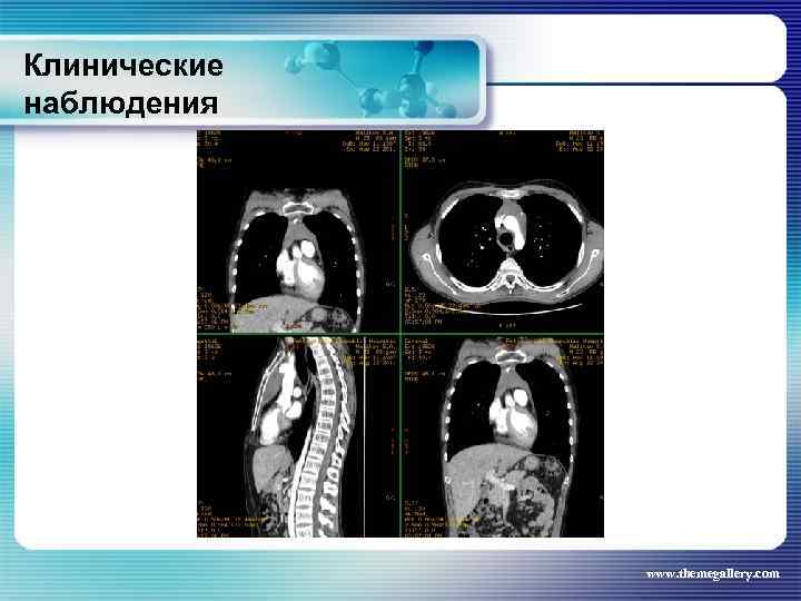 Клинические наблюдения www. themegallery. com 