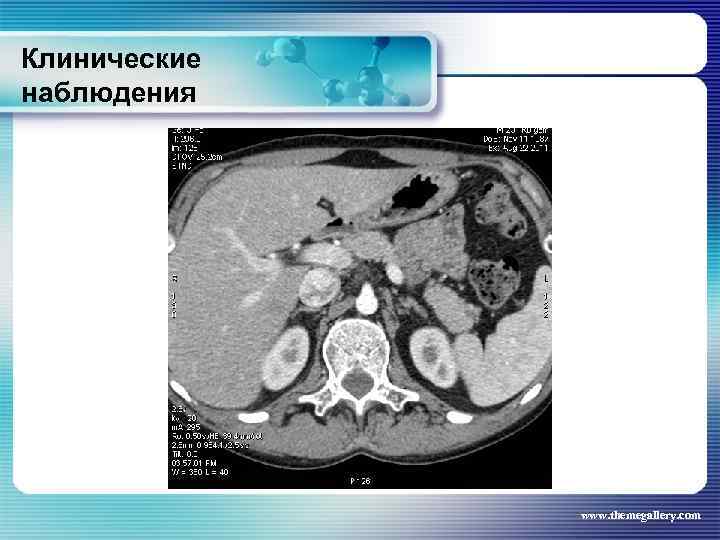 Клинические наблюдения www. themegallery. com 