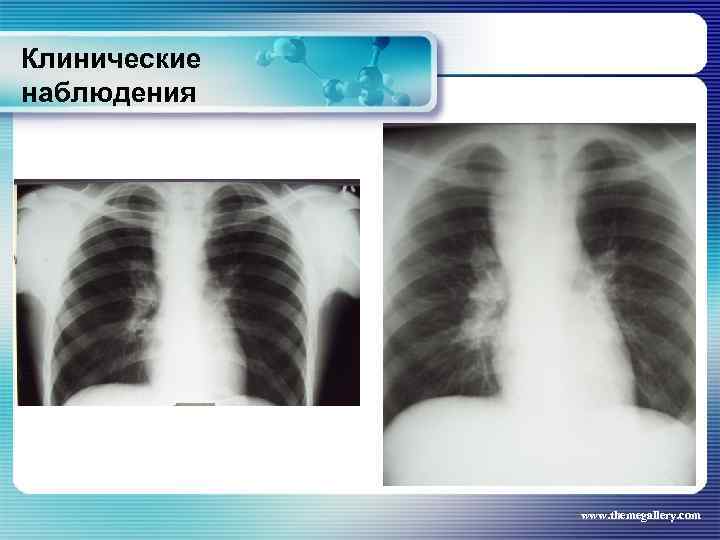 Клинические наблюдения www. themegallery. com 