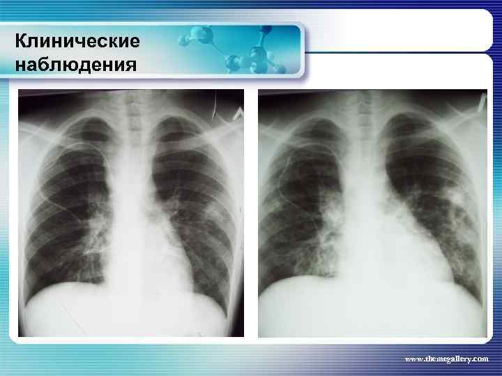 Клинические наблюдения www. themegallery. com 
