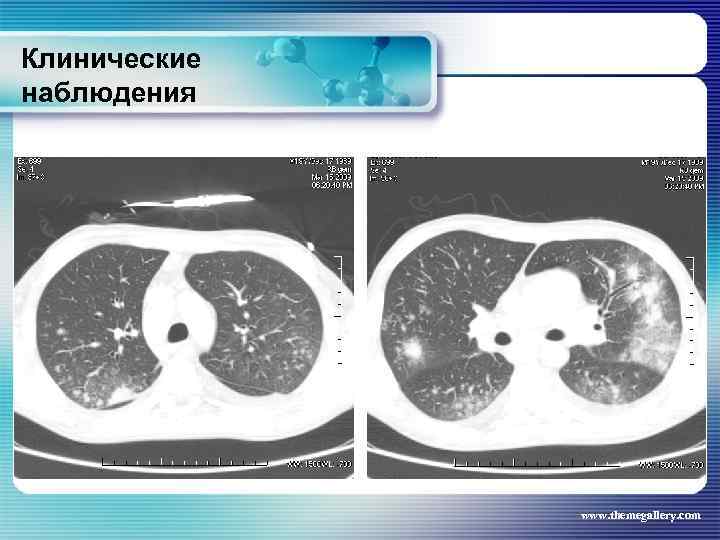 Клинические наблюдения www. themegallery. com 