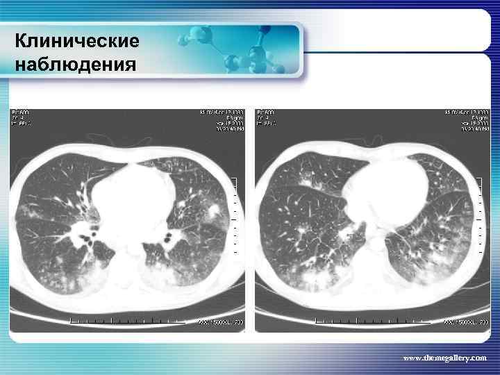 Клинические наблюдения www. themegallery. com 