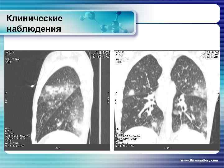 Клинические наблюдения www. themegallery. com 