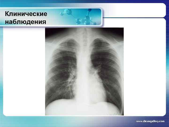 Клинические наблюдения www. themegallery. com 