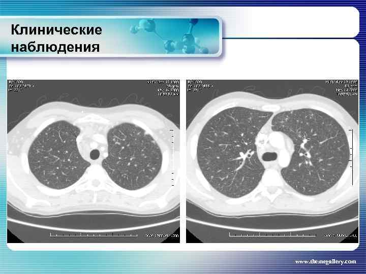Клинические наблюдения www. themegallery. com 