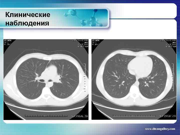 Клинические наблюдения www. themegallery. com 