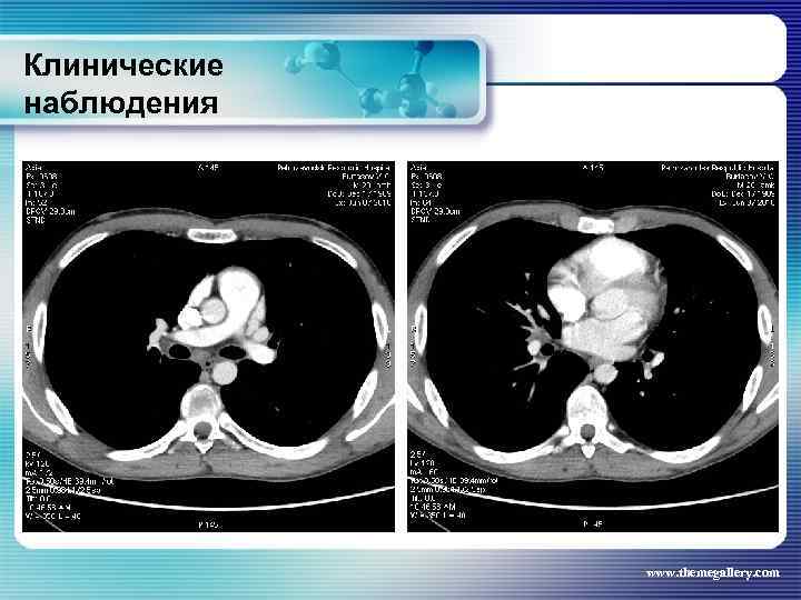 Клинические наблюдения www. themegallery. com 