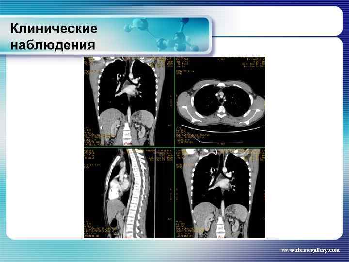 Клинические наблюдения www. themegallery. com 