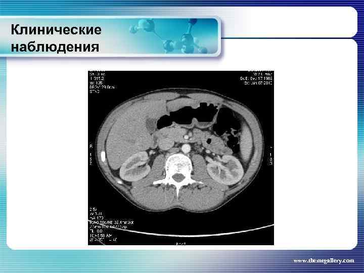 Клинические наблюдения www. themegallery. com 