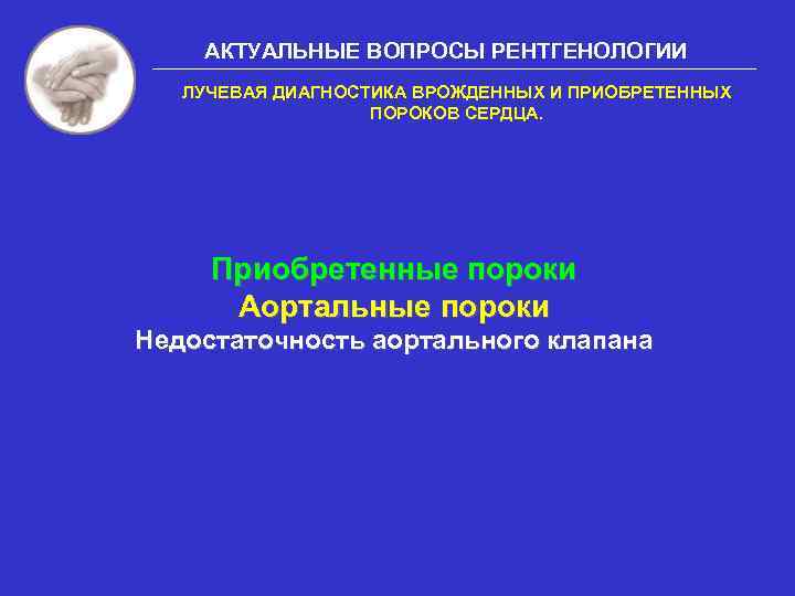 АКТУАЛЬНЫЕ ВОПРОСЫ РЕНТГЕНОЛОГИИ ЛУЧЕВАЯ ДИАГНОСТИКА ВРОЖДЕННЫХ И ПРИОБРЕТЕННЫХ ПОРОКОВ СЕРДЦА. Приобретенные пороки Аортальные пороки