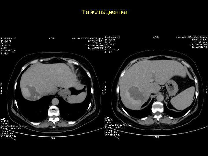 Та же пациентка 