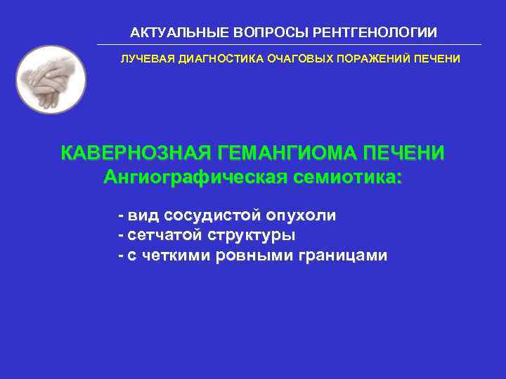 АКТУАЛЬНЫЕ ВОПРОСЫ РЕНТГЕНОЛОГИИ ЛУЧЕВАЯ ДИАГНОСТИКА ОЧАГОВЫХ ПОРАЖЕНИЙ ПЕЧЕНИ КАВЕРНОЗНАЯ ГЕМАНГИОМА ПЕЧЕНИ Ангиографическая семиотика: -