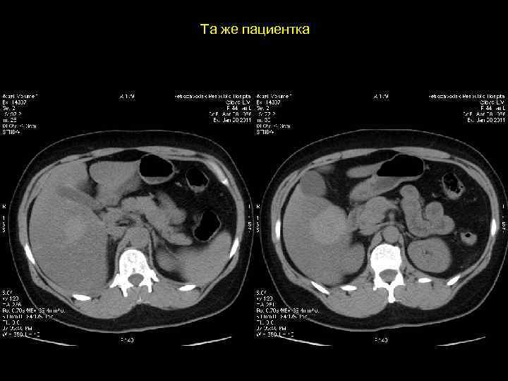 Та же пациентка 