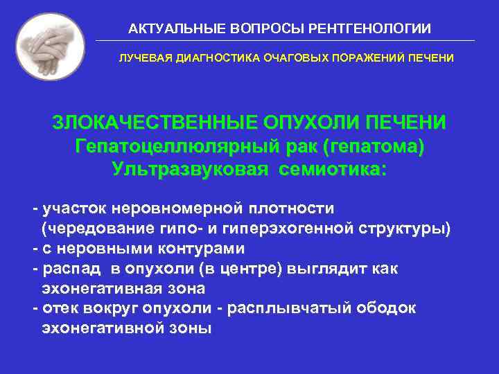 АКТУАЛЬНЫЕ ВОПРОСЫ РЕНТГЕНОЛОГИИ ЛУЧЕВАЯ ДИАГНОСТИКА ОЧАГОВЫХ ПОРАЖЕНИЙ ПЕЧЕНИ ЗЛОКАЧЕСТВЕННЫЕ ОПУХОЛИ ПЕЧЕНИ Гепатоцеллюлярный рак (гепатома)