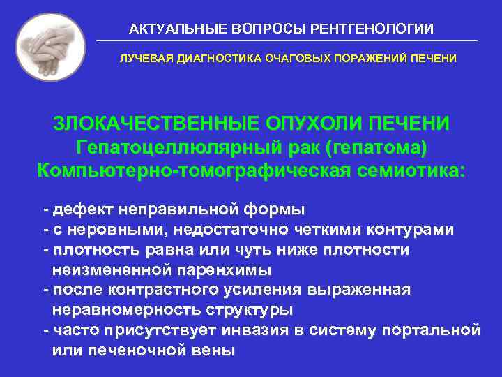 АКТУАЛЬНЫЕ ВОПРОСЫ РЕНТГЕНОЛОГИИ ЛУЧЕВАЯ ДИАГНОСТИКА ОЧАГОВЫХ ПОРАЖЕНИЙ ПЕЧЕНИ ЗЛОКАЧЕСТВЕННЫЕ ОПУХОЛИ ПЕЧЕНИ Гепатоцеллюлярный рак (гепатома)