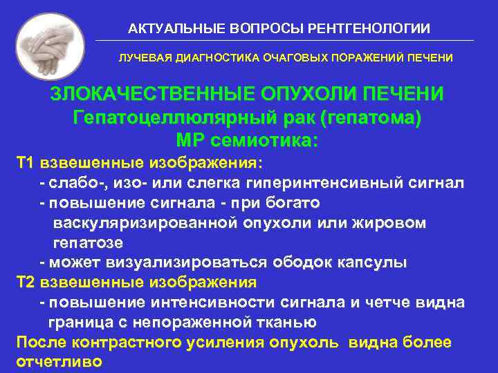 АКТУАЛЬНЫЕ ВОПРОСЫ РЕНТГЕНОЛОГИИ ЛУЧЕВАЯ ДИАГНОСТИКА ОЧАГОВЫХ ПОРАЖЕНИЙ ПЕЧЕНИ ЗЛОКАЧЕСТВЕННЫЕ ОПУХОЛИ ПЕЧЕНИ Гепатоцеллюлярный рак (гепатома)