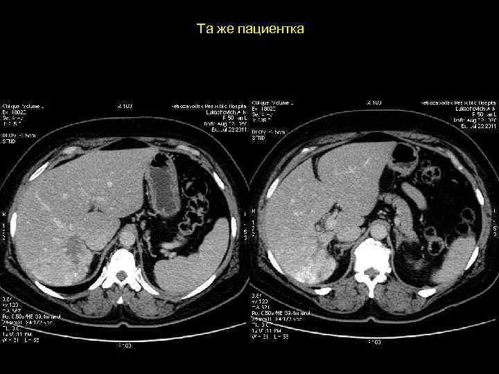 Та же пациентка 