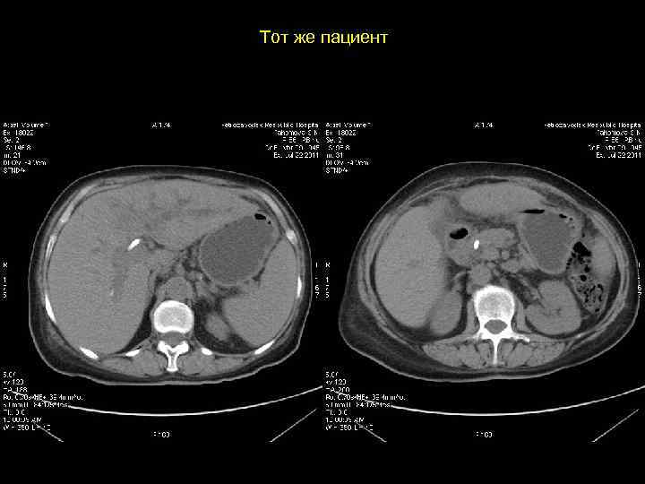 Тот же пациент 