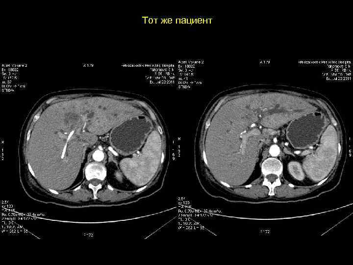Тот же пациент 