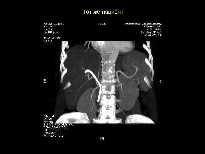 Тот же пациент 