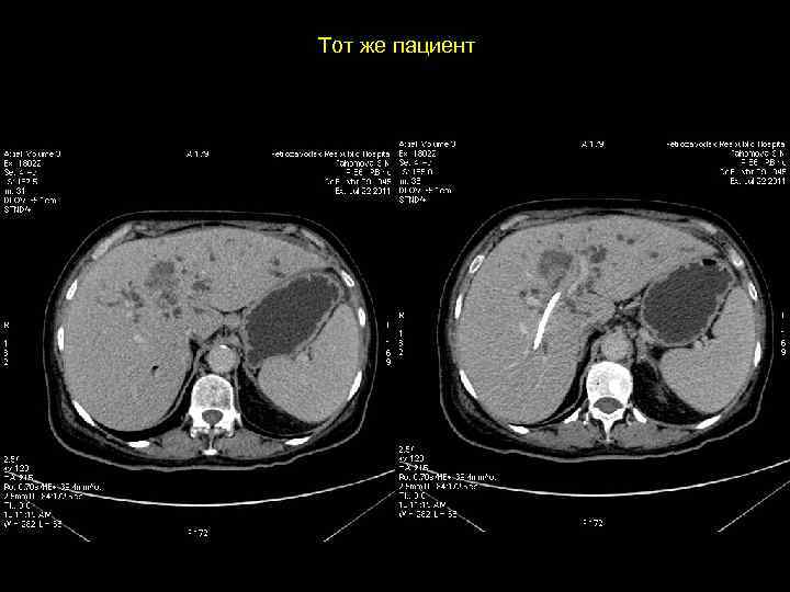 Тот же пациент 