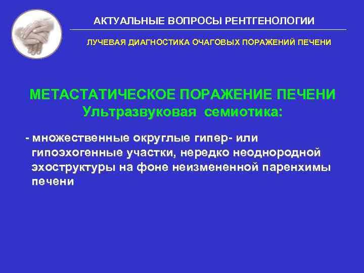 АКТУАЛЬНЫЕ ВОПРОСЫ РЕНТГЕНОЛОГИИ ЛУЧЕВАЯ ДИАГНОСТИКА ОЧАГОВЫХ ПОРАЖЕНИЙ ПЕЧЕНИ МЕТАСТАТИЧЕСКОЕ ПОРАЖЕНИЕ ПЕЧЕНИ Ультразвуковая семиотика: -