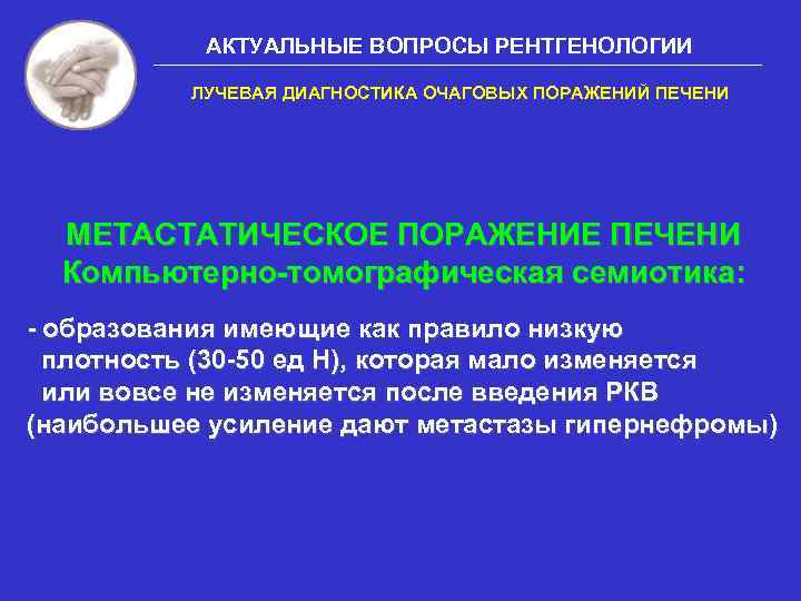 АКТУАЛЬНЫЕ ВОПРОСЫ РЕНТГЕНОЛОГИИ ЛУЧЕВАЯ ДИАГНОСТИКА ОЧАГОВЫХ ПОРАЖЕНИЙ ПЕЧЕНИ МЕТАСТАТИЧЕСКОЕ ПОРАЖЕНИЕ ПЕЧЕНИ Компьютерно-томографическая семиотика: -