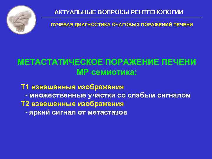 АКТУАЛЬНЫЕ ВОПРОСЫ РЕНТГЕНОЛОГИИ ЛУЧЕВАЯ ДИАГНОСТИКА ОЧАГОВЫХ ПОРАЖЕНИЙ ПЕЧЕНИ МЕТАСТАТИЧЕСКОЕ ПОРАЖЕНИЕ ПЕЧЕНИ МР семиотика: Т