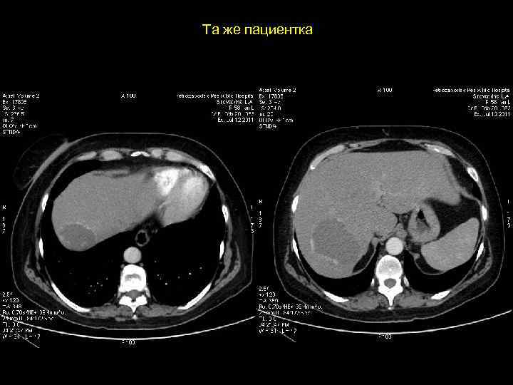 Та же пациентка 